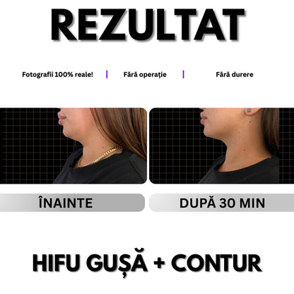 GUȘĂ - Pentru Grăsime / Piele Lăsată