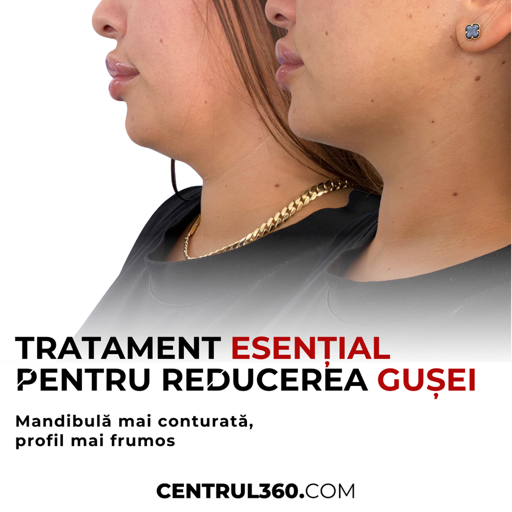 Grăsime localizată