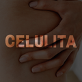 Celulită